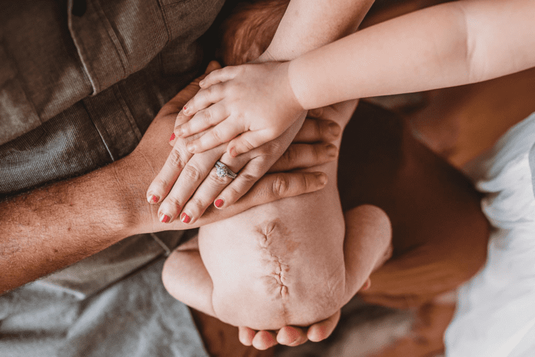 In-Utero Surgery Improves Outcomes for Babies with Spina Bifida