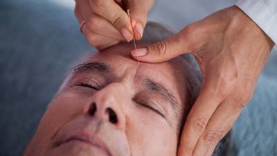 Man recieves acupuncture treatment to eyebrow